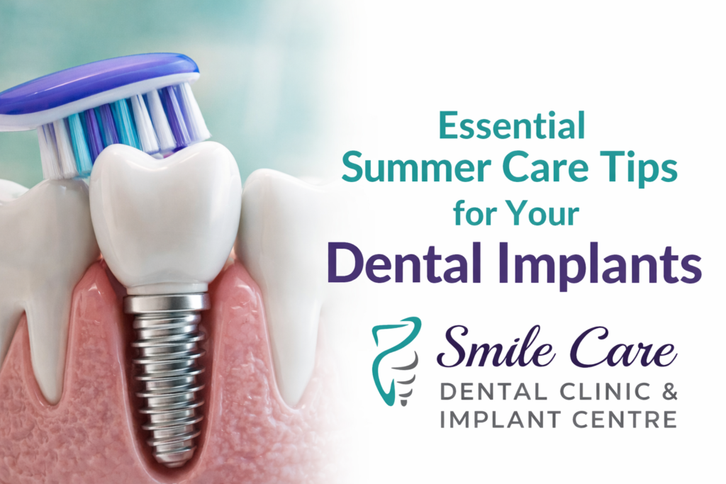 Essential Summer Care Tips for Your Dental Implants