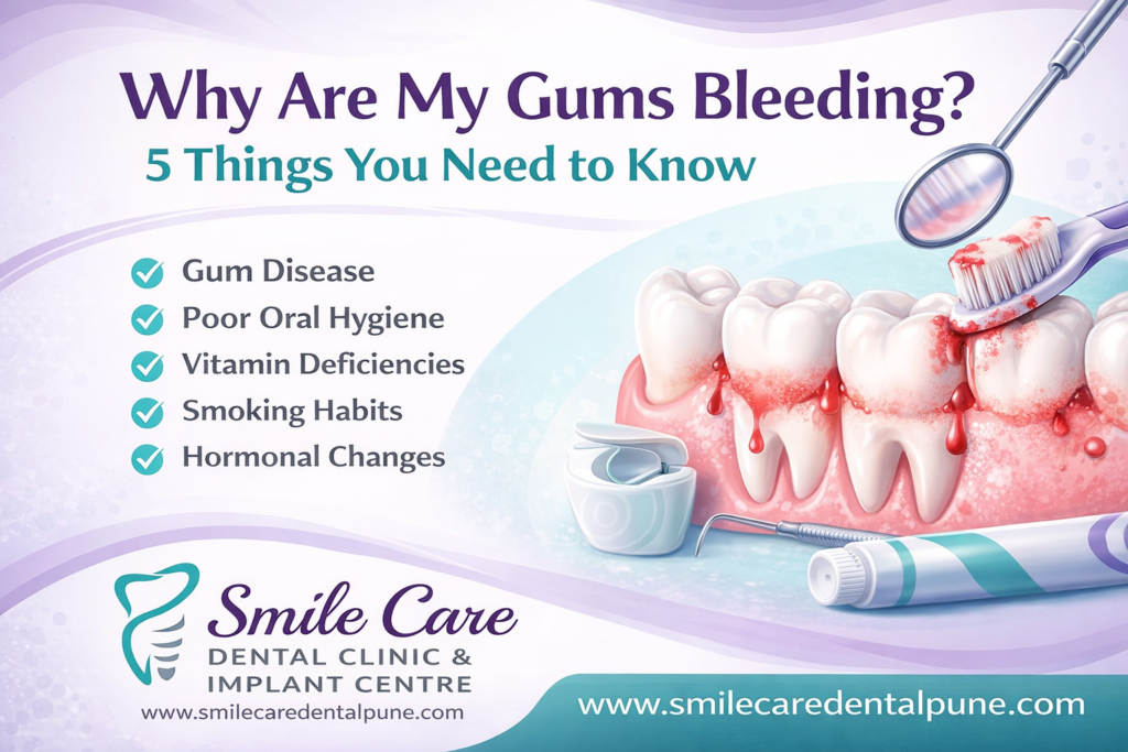 Why Are My Gums Bleeding 5 Things You Need to Know